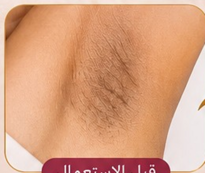 قبل استعمال بودرة الإبط